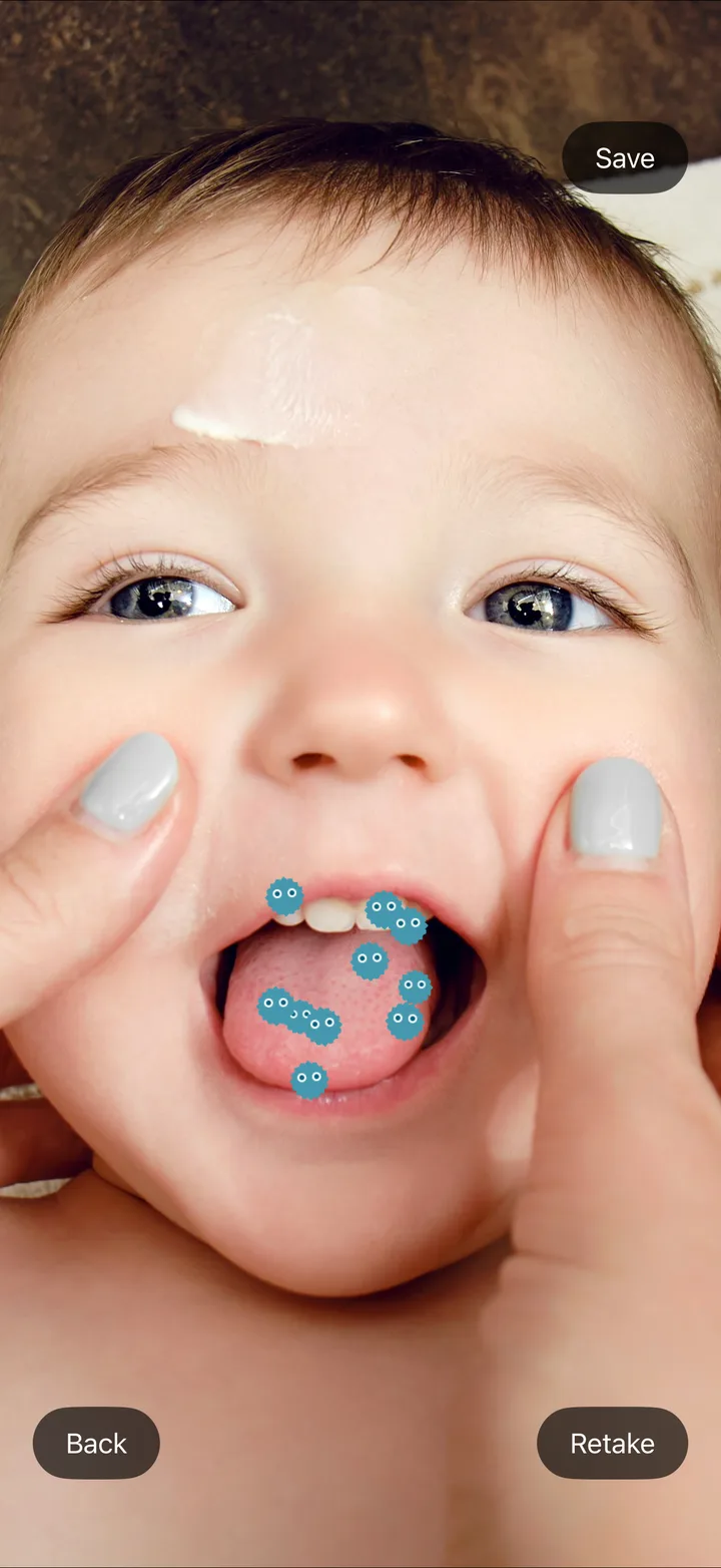 GERM CAMERA result screen with germ characters placed inside the mouth